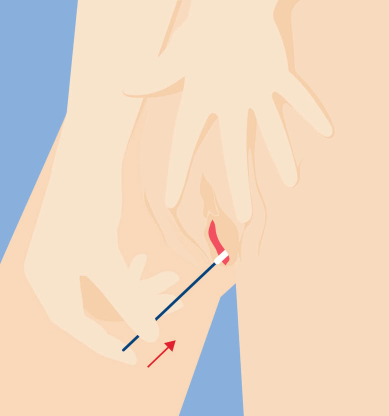 Illustration einer Hand, die einen Teststäbchen in die Vagina einführt, mit einem Pfeil, der die Richtung anzeigt.